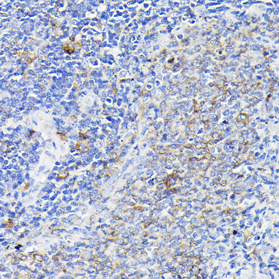 Notch1 Rabbit polyclonal antibody