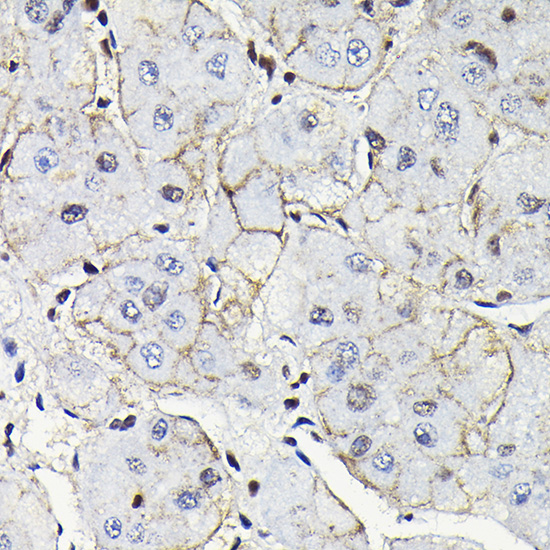 Notch1 Rabbit polyclonal antibody