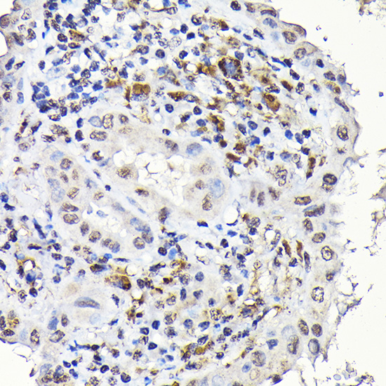 Notch1 Rabbit polyclonal antibody