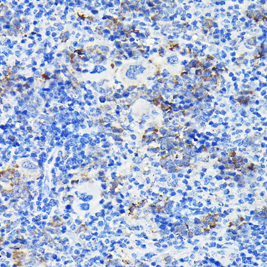 Notch1 Rabbit polyclonal antibody