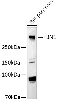 Fibrillin 1 Rabbit polyclonal antibody