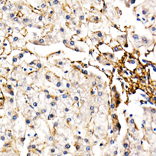 Fibrillin 1 Rabbit polyclonal antibody