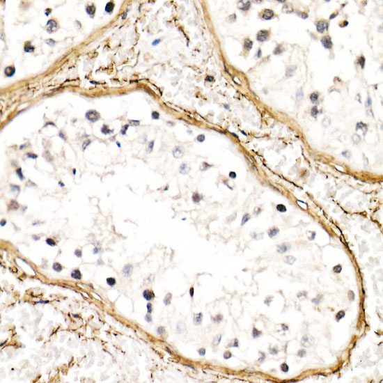 Fibrillin 1 Rabbit polyclonal antibody