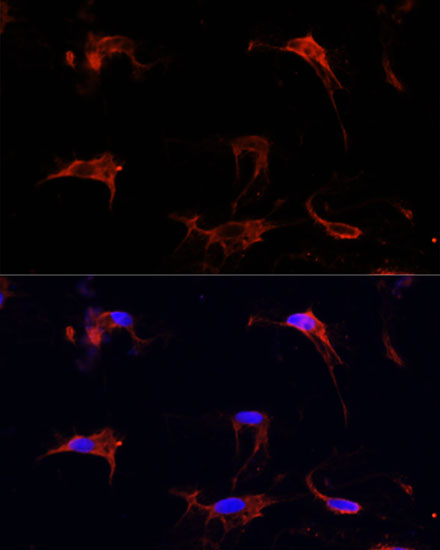 Fibrillin 1 Rabbit polyclonal antibody