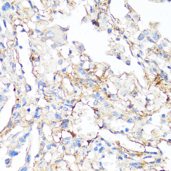 Fibronectin Rabbit polyclonal antibody