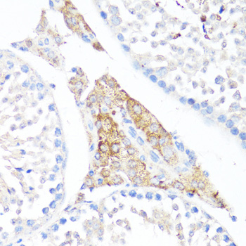 Fibronectin Rabbit polyclonal antibody