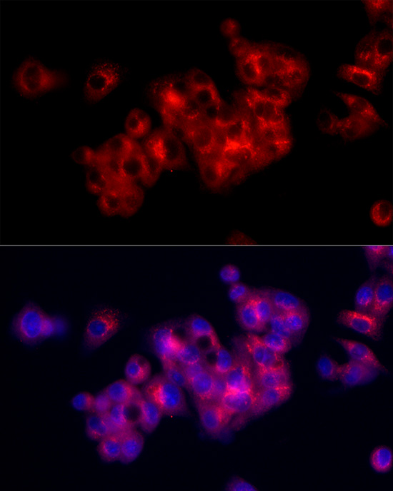 Fibronectin Rabbit polyclonal antibody