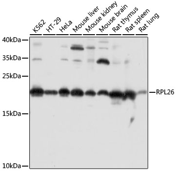 RPL26 Rabbit polyclonal antibody