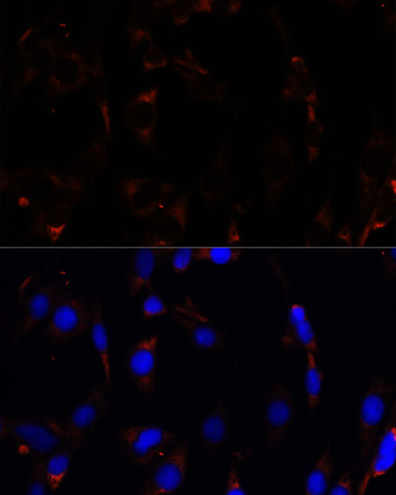 RPL26 Rabbit polyclonal antibody