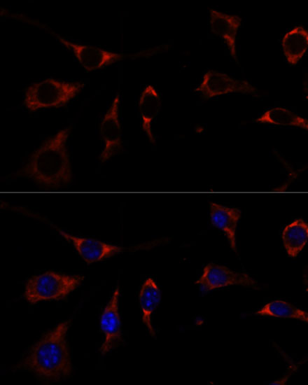 RPL26 Rabbit polyclonal antibody