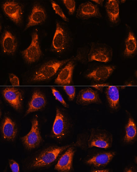 RPL26 Rabbit polyclonal antibody
