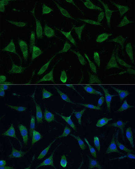LSM14A Rabbit polyclonal antibody