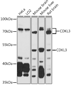 CDKL3 Rabbit polyclonal antibody
