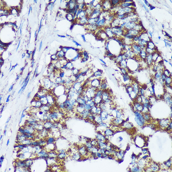 CDKL3 Rabbit polyclonal antibody