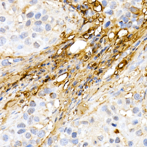 Decorin Rabbit polyclonal antibody