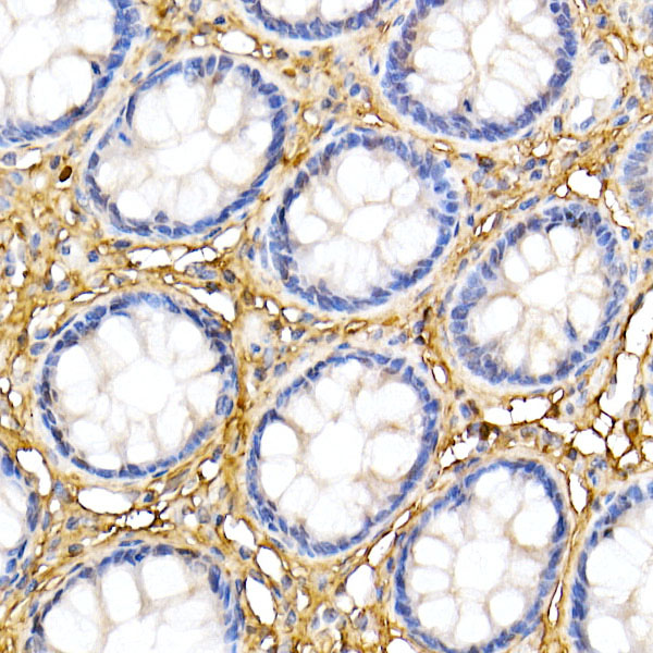 Decorin Rabbit polyclonal antibody