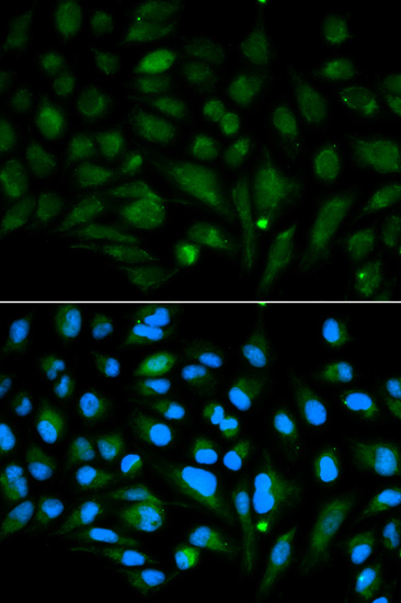Decorin Rabbit polyclonal antibody