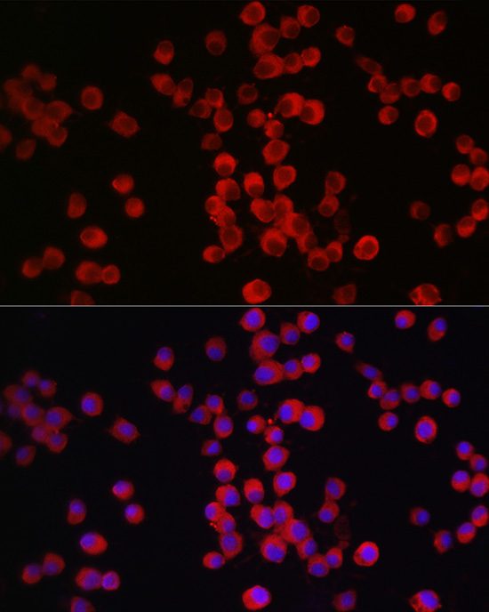 Neuropilin-1 (NRP1) Rabbit polyclonal antibody