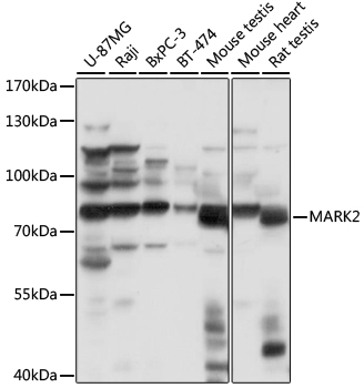 MARK2 Rabbit polyclonal antibody