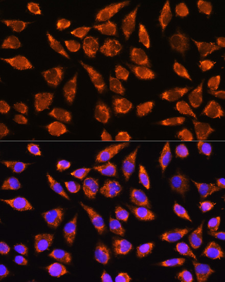 MARK2 Rabbit polyclonal antibody