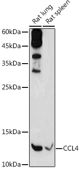 CCL4 Rabbit polyclonal antibody