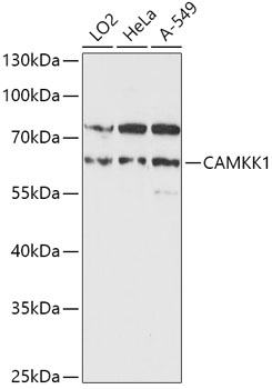 CAMKK1 Rabbit polyclonal antibody