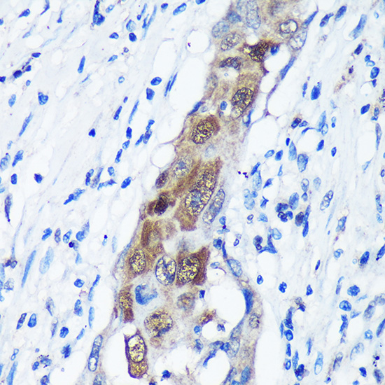 CAMKK1 Rabbit polyclonal antibody