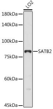 SATB2 Rabbit polyclonal antibody