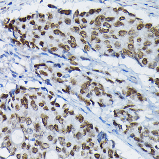 SATB2 Rabbit polyclonal antibody