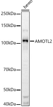 AMOTL2 Rabbit polyclonal antibody