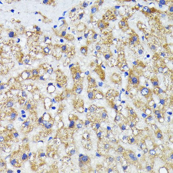 AMOTL2 Rabbit polyclonal antibody