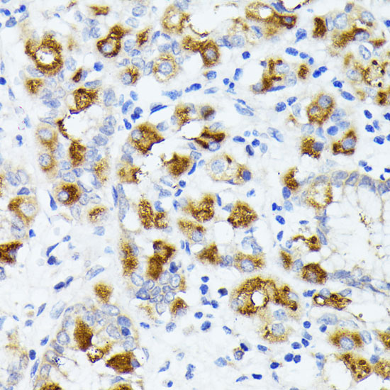 AMOTL2 Rabbit polyclonal antibody