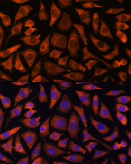 RABGGTA Rabbit polyclonal antibody