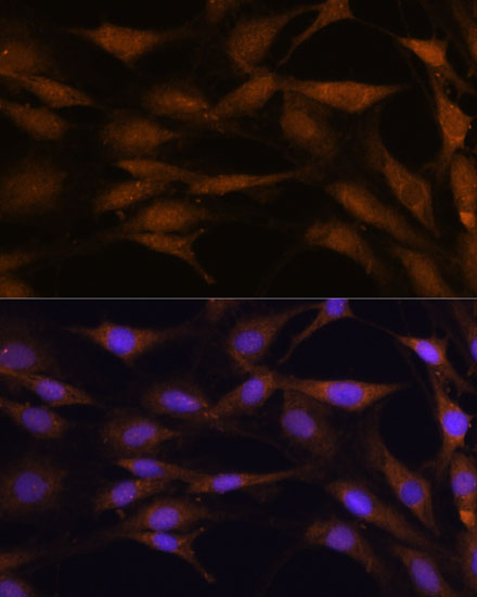 [KO Validated] TFAP4 Rabbit polyclonal antibody