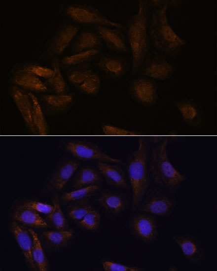 [KO Validated] TFAP4 Rabbit polyclonal antibody