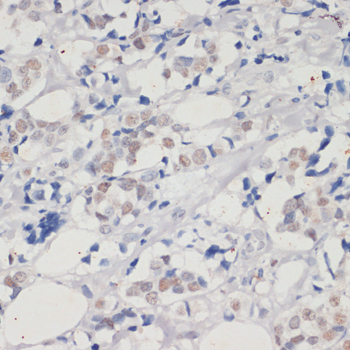 [KD Validated] DNMT1 Rabbit polyclonal antibody