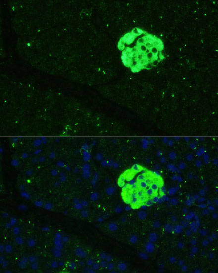 SFRP5 Rabbit polyclonal antibody