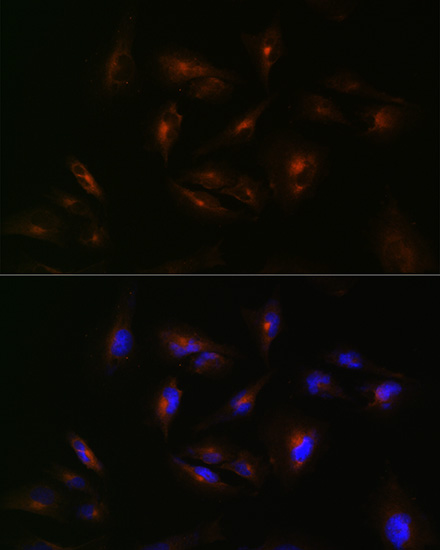 ABCA2 Rabbit polyclonal antibody