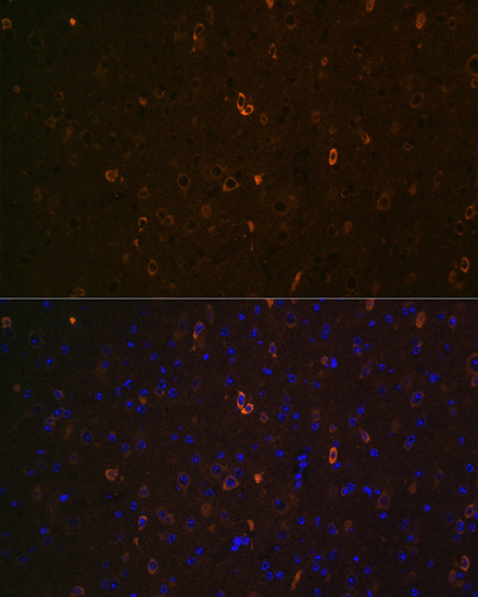 ABCA2 Rabbit polyclonal antibody