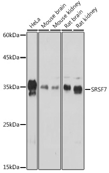 SRSF7 Rabbit polyclonal antibody