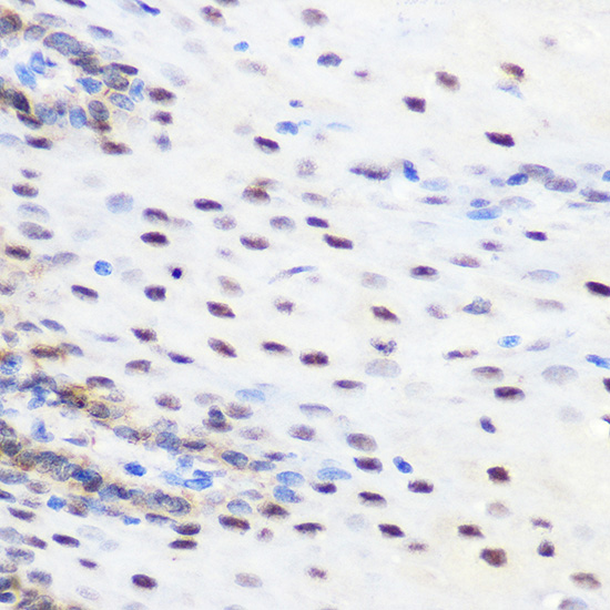 SRSF7 Rabbit polyclonal antibody