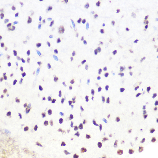 SRSF7 Rabbit polyclonal antibody