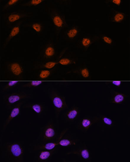 SRSF7 Rabbit polyclonal antibody
