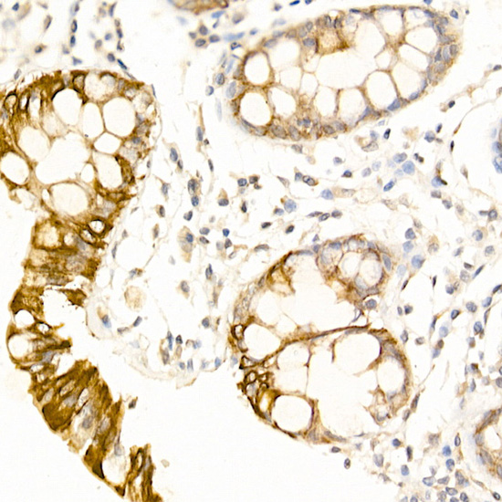 USP18 Rabbit polyclonal antibody