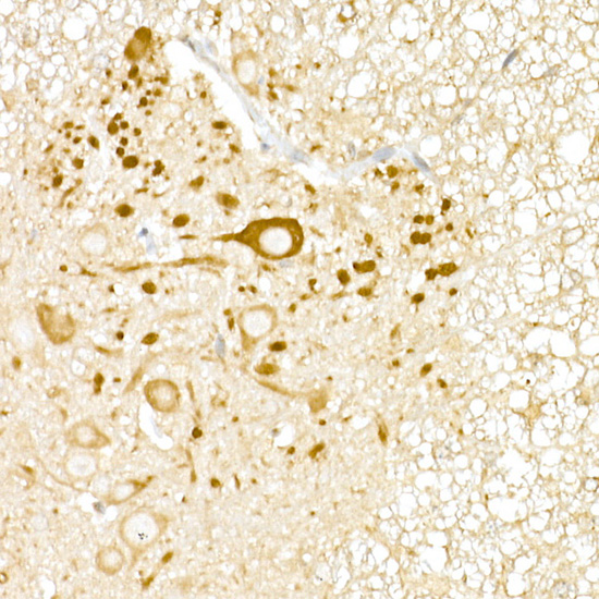 USP18 Rabbit polyclonal antibody