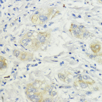 SURF4 Rabbit polyclonal antibody