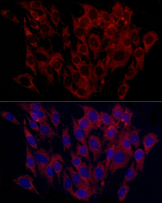 SURF4 Rabbit polyclonal antibody