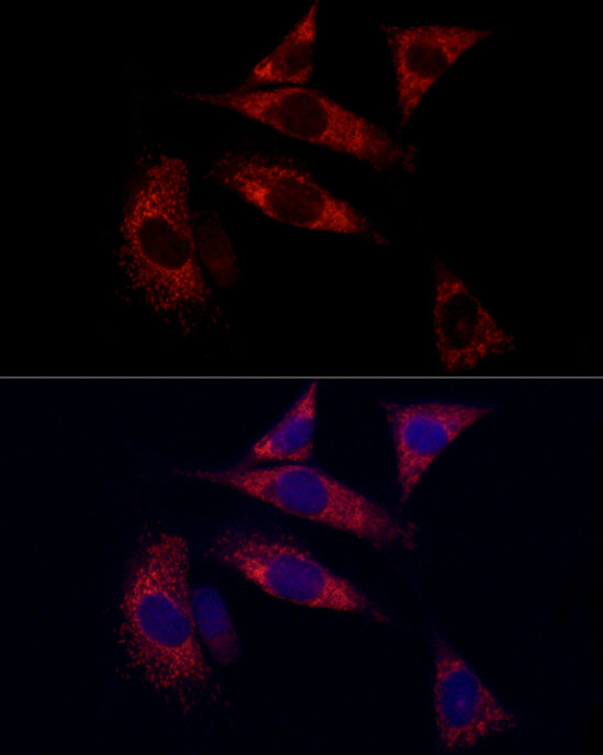 SURF4 Rabbit polyclonal antibody
