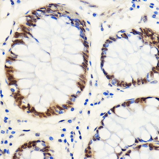 SNIP1 Rabbit polyclonal antibody