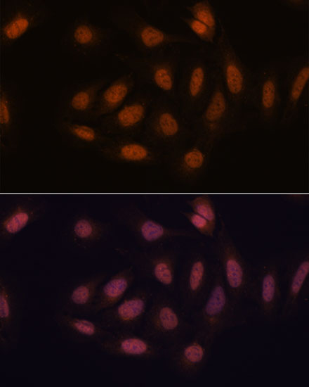 SNIP1 Rabbit polyclonal antibody